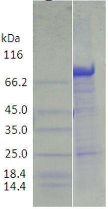 15% SDS-PAGE analysis profiles of purified AB57_1059-25-754 (CBB stained).